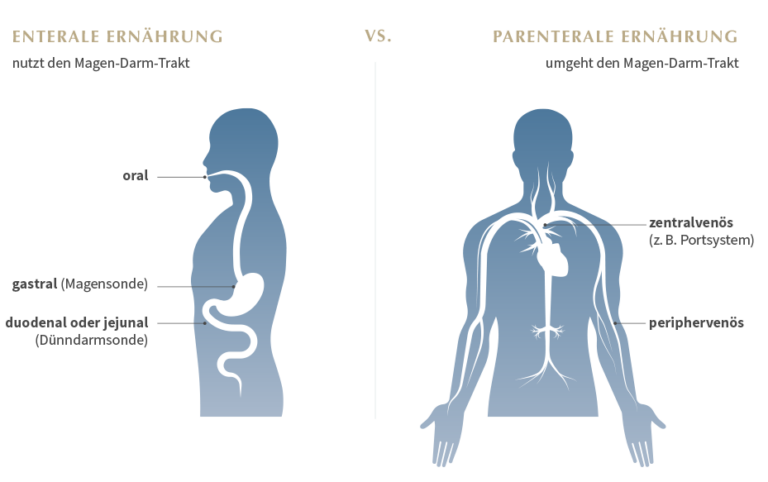 Parenterale Ernährung Vor Und Nachteile www.caresolution.de
