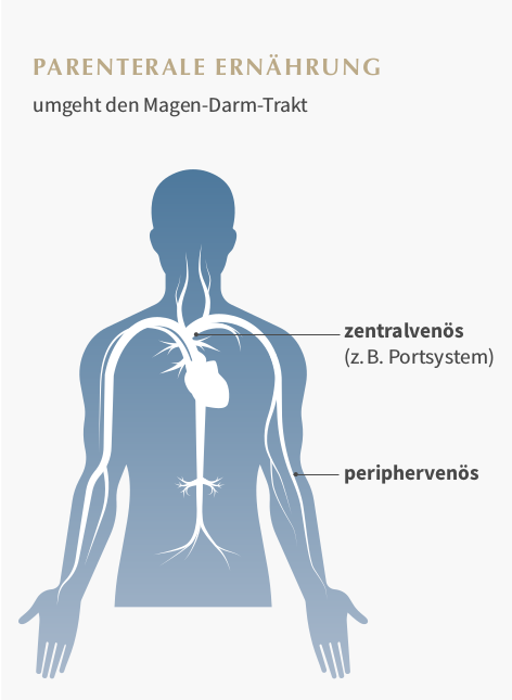 Parenterale Ernährung Grafik